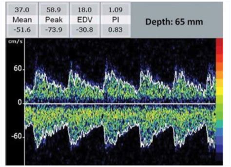 ANKI CNS , CNS ANAT PT II Flashcards | Quizlet