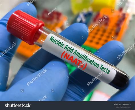 Blood Sample Nucleic Acid Amplification Tests Stock Photo 2364168819 ...