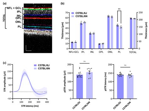 Retinal Ganglion Cells: Global Number, Density and Vulnerability to ...