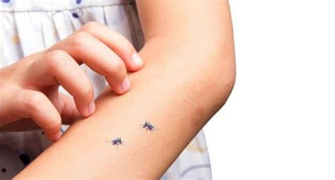 Banana is all you need to treat a mosquito bite | TheHealthSite.com