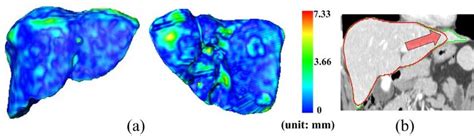 Draw Surface Distance Map 的图像结果