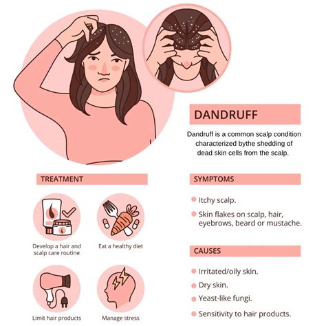 Dandruff: Causes, Risk Factors, Symptoms, Treatment