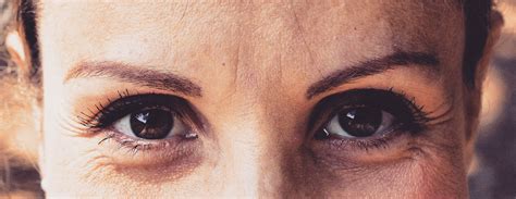 Image result for Slit Lamp Exam Tutorial