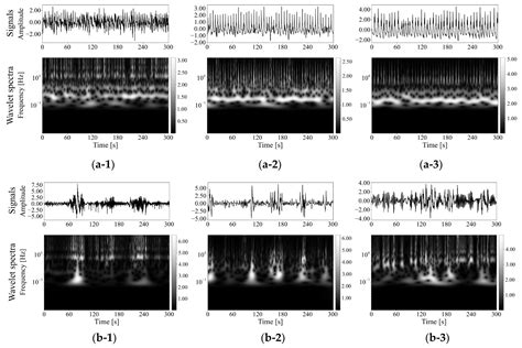 Complex-Valued Wavelet Spectrum Analysis of Respiratory Conditions and ...