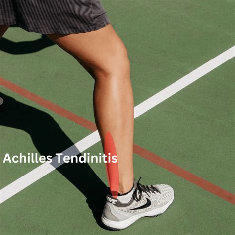 Achilles Tendonitis: Symptoms, Treatment, Exercises – DZED