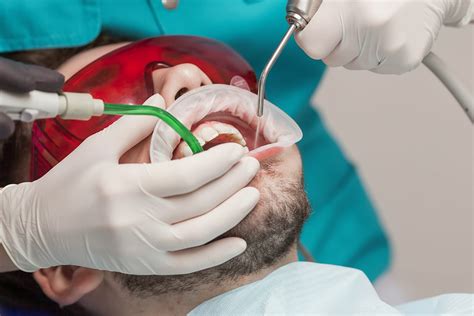 Root Canal Crown in Singapore | Get a Crown after a Root Canal