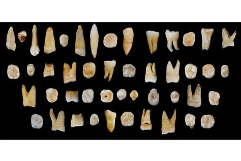 Scientists Found an Unexpected Sign of Human Longevity—Our Teeth