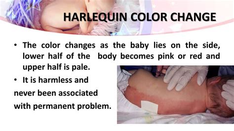 Assessment of newborn | PPTX