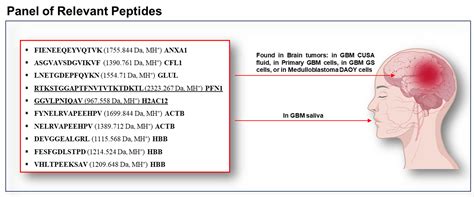 Proteomic Profiling of Pre- and Post-Surgery Saliva of Glioblastoma ...