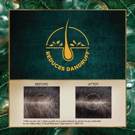 Indulekha Dandruff Treatment Shampoo