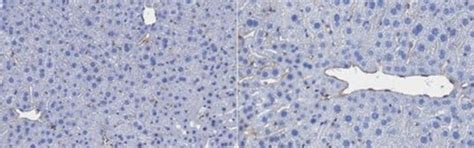 Anti-PLVAP Antibody, clone MECA-32 clone MECA-32, from rat | Sigma-Aldrich