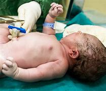 Image result for umbilical cord