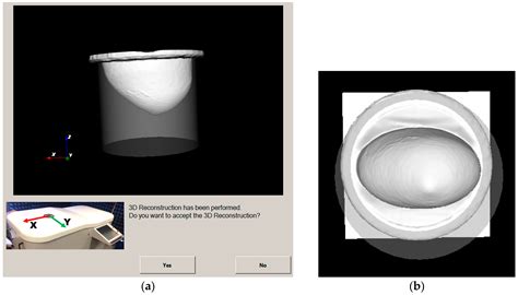 On-Site Validation of a Microwave Breast Imaging System, before First ...