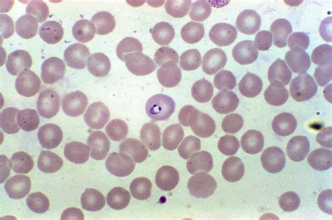 Free picture: photomicrograph, blood smear, revealing, erythrocyte ...