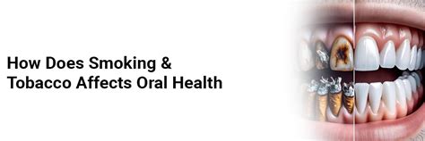 How does Smoking & Tobacco affects oral health | Medtalks