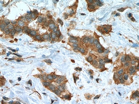 iASPP antibody (18590-1-AP) | Proteintech
