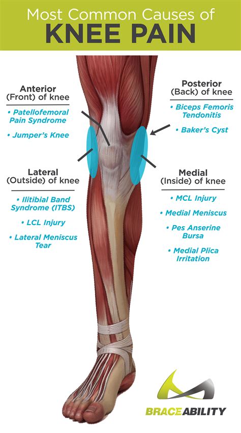 Knee pain: Do you or does someone you know have knee pain? The first ...
