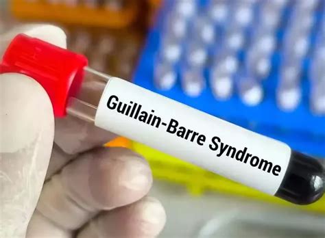 GBS आजार म्हणजे काय? कशी घ्याल काळजी... | स्थैर्य