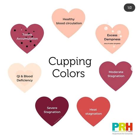 Cupping what it is and why you should try it – Artofit