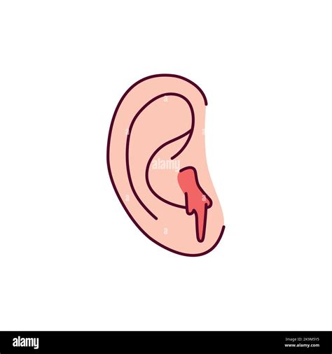 Pierced Ears Bleeding at Noma Andrews blog