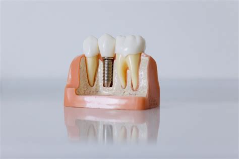 Can Tooth Enamel Grow Back? – supersmile