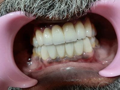 Gallery - PROFILE ORTHODONTICS & COSMETIC DENTISTRY