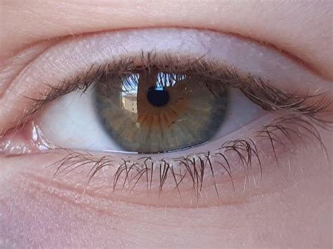 What is Corneal blindness? Why 6.8M people in India suffer from this ...