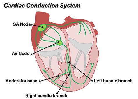 Image result for Cardiac Conduction Disorders Examples
