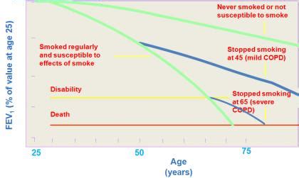 All about COPD -Dr Srikant Sharma