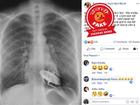 Fact Check: ਛਾਤੀ ਦੇ X-Ray ਨੂੰ ਲੈ ਕੇ ਫਰਜ਼ੀ ਦਾਅਵਾ ਸੋਸ਼ਲ ਮੀਡੀਆ 'ਤੇ ਕੀਤਾ ਜਾ ...