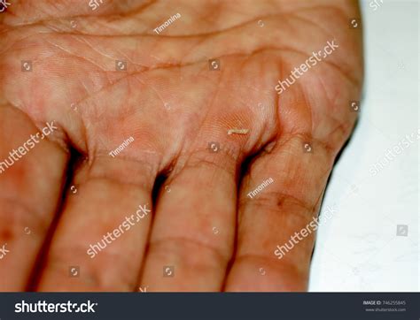 Calluses On Palm Fingers Hand Labor Stock Photo (Edit Now) 746255845