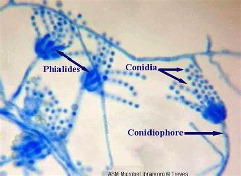 https://www.medical-labs.net/wp-content/uploads/2015/03/Conidiophore-Phialides-Conidia.jpg