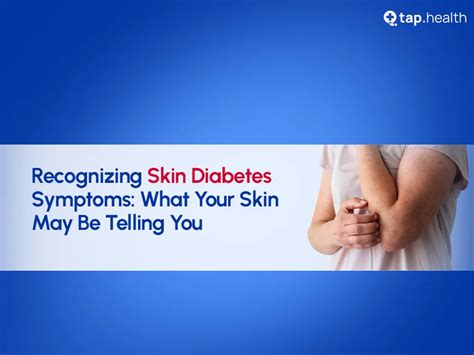 जानिए स्किन डायबिटीज के लक्षण, प्रभाव और रोकथाम के उपाय