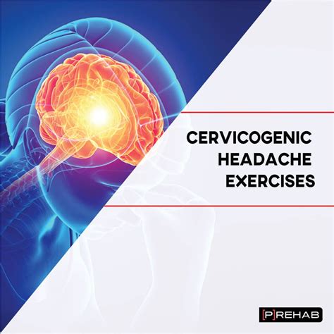 Cervicogenic Headache Physical Therapy