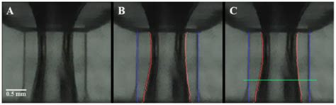 Air-Core–Liquid-Ring (ACLR) Atomization Part II: Influence of Process ...