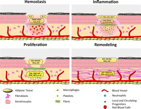 Wound Healing Yellow Discharge at Jonathan Landseer blog