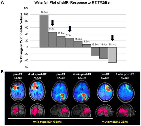 Mutant Isocitrate Dehydrogenase 1 Expression Enhances Response of ...