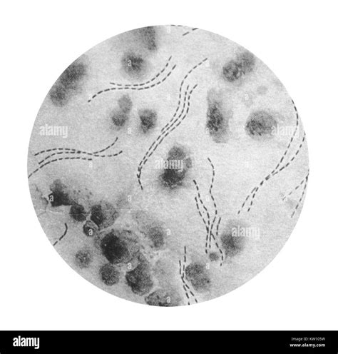 Chancroid bacteria Cut Out Stock Images & Pictures - Alamy