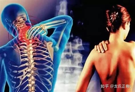 正确认识中医正骨的好处 正骨没有这些功效_腾讯新闻