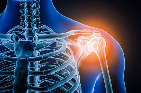 10 Remedies for Quick Relief from Shoulder Pain - Tarmeem
