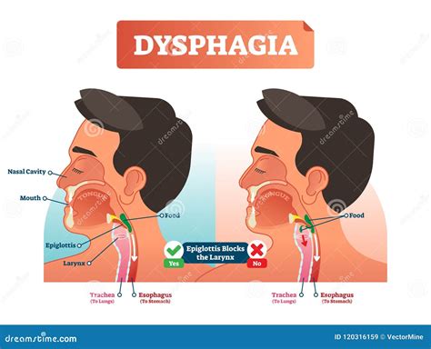 Trachea And Esophagus