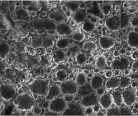 Ein kleiner Schritt für den Dermatologen, ein Quantensprung in der Dia ...