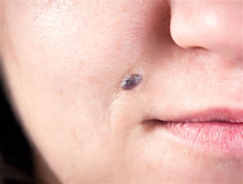 女性面部痣的位置图解 女人脸上最好的8颗痣→MAIGOO知识