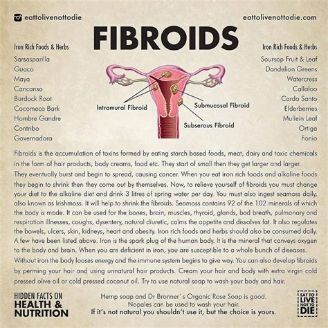 Best 11 How to get rid of large fibroids naturally without surgery Home remedies to shrink ...