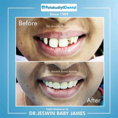 Palakudyil Dental Speciality Centre in Changanacherry,Kottayam - Best ...