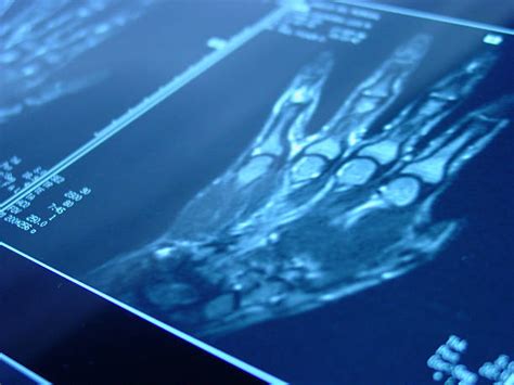 Image result for High-Resolution Hand MRI