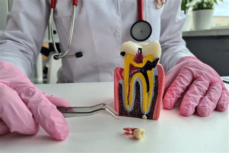 Root Canal Pain: Causes & Management