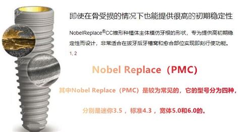 诺贝尔pmc种植体和pcc哪个好,PCC适合即刻种植PMC价格便宜哦~ - 行业资讯 - 开立特口腔