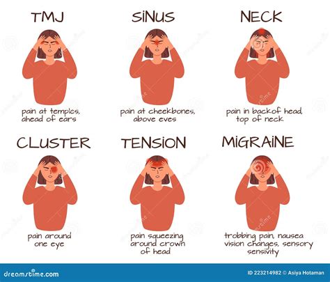 Headache Types. Headaches Areas Infographic Diagram Medical Poster ...
