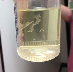 White stuff in pee | BabyCenter